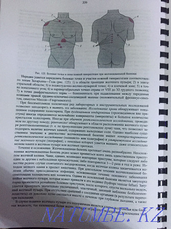 Пропедевтика внутренних болезней Алматы - изображение 3