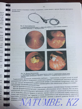 Пропедевтика внутренних болезней Алматы - изображение 2