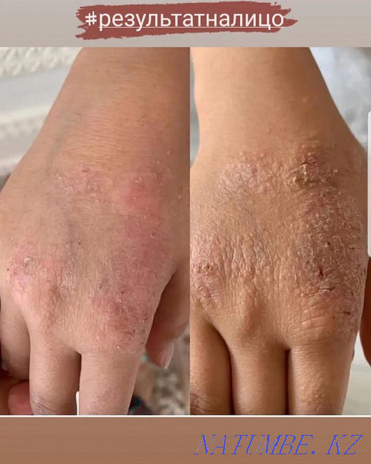 Ionizer for kitchen and shower Shymkent - photo 5