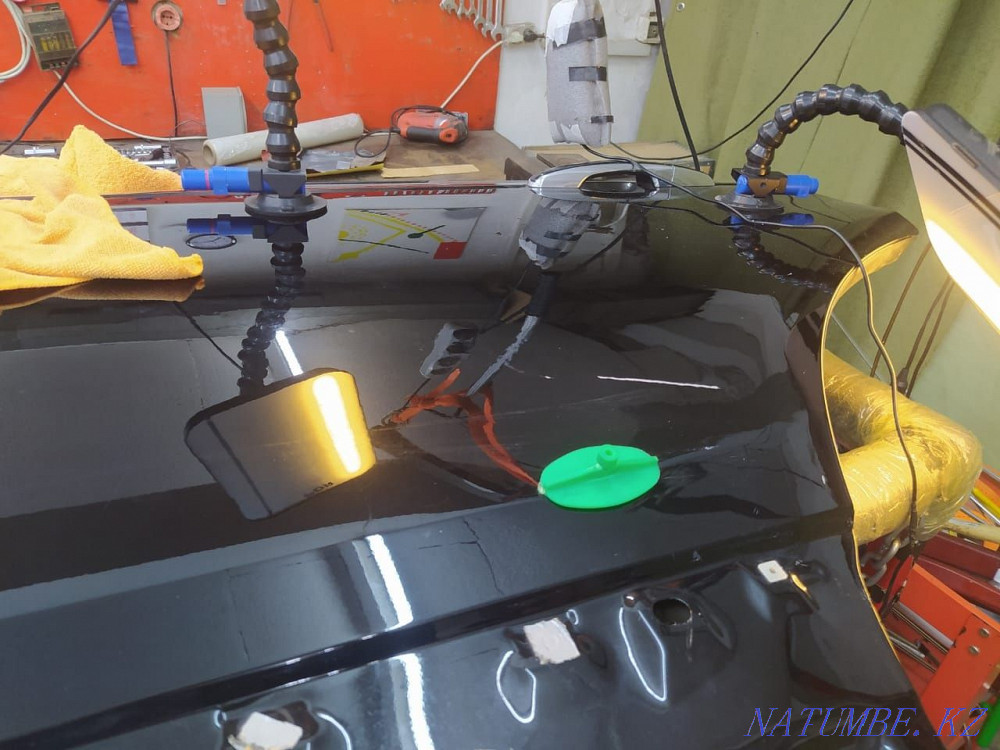 Тіс тарту  Алматы - изображение 3