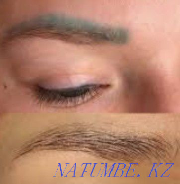 Tattoo removal with remover 5000 tn Kostanay - photo 1