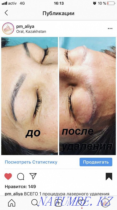 Акция.3500 вместо7000Удаление старого Татуажа.Лазер нового поколения. Уральск - изображение 3