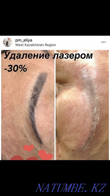 Акция.3500 вместо7000Удаление старого Татуажа.Лазер нового поколения. Уральск - изображение 1