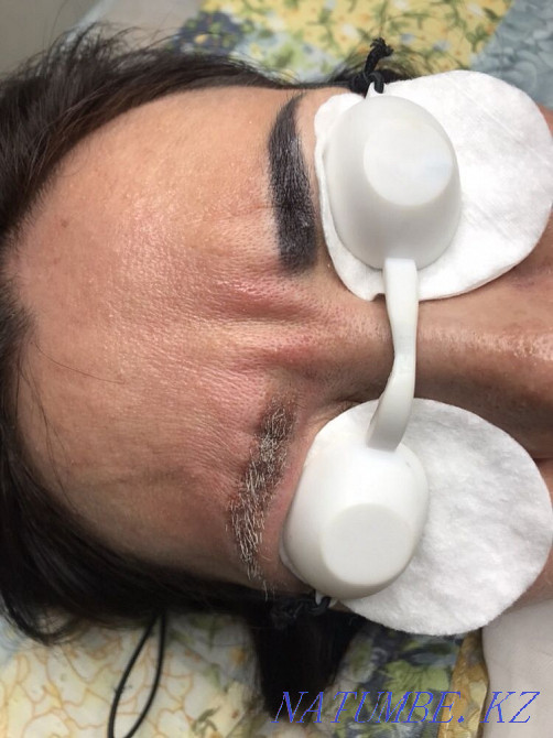 Акция.3500 вместо7000Удаление старого Татуажа.Лазер нового поколения. Уральск - изображение 5