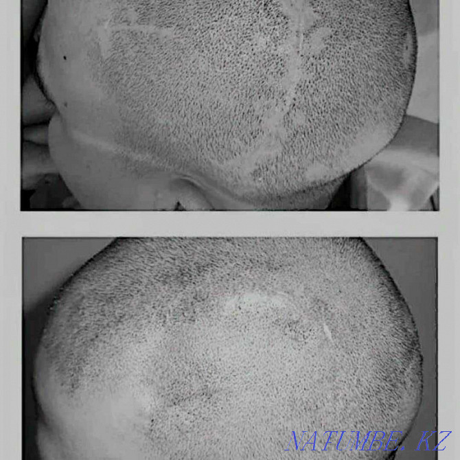 Tattoo medical areola, scars, scars, vitiligo, alopecia Almaty - photo 1