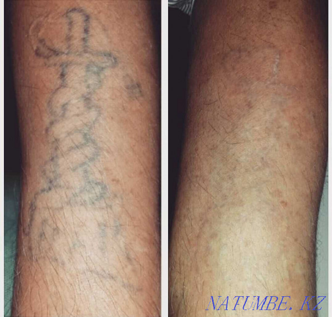 Permanent tattoo, laser removal, carbon peeling, BrowBar Almaty - photo 6