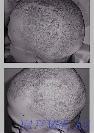 Permanent tattoo, laser removal, carbon peeling, BrowBar Almaty - photo 2