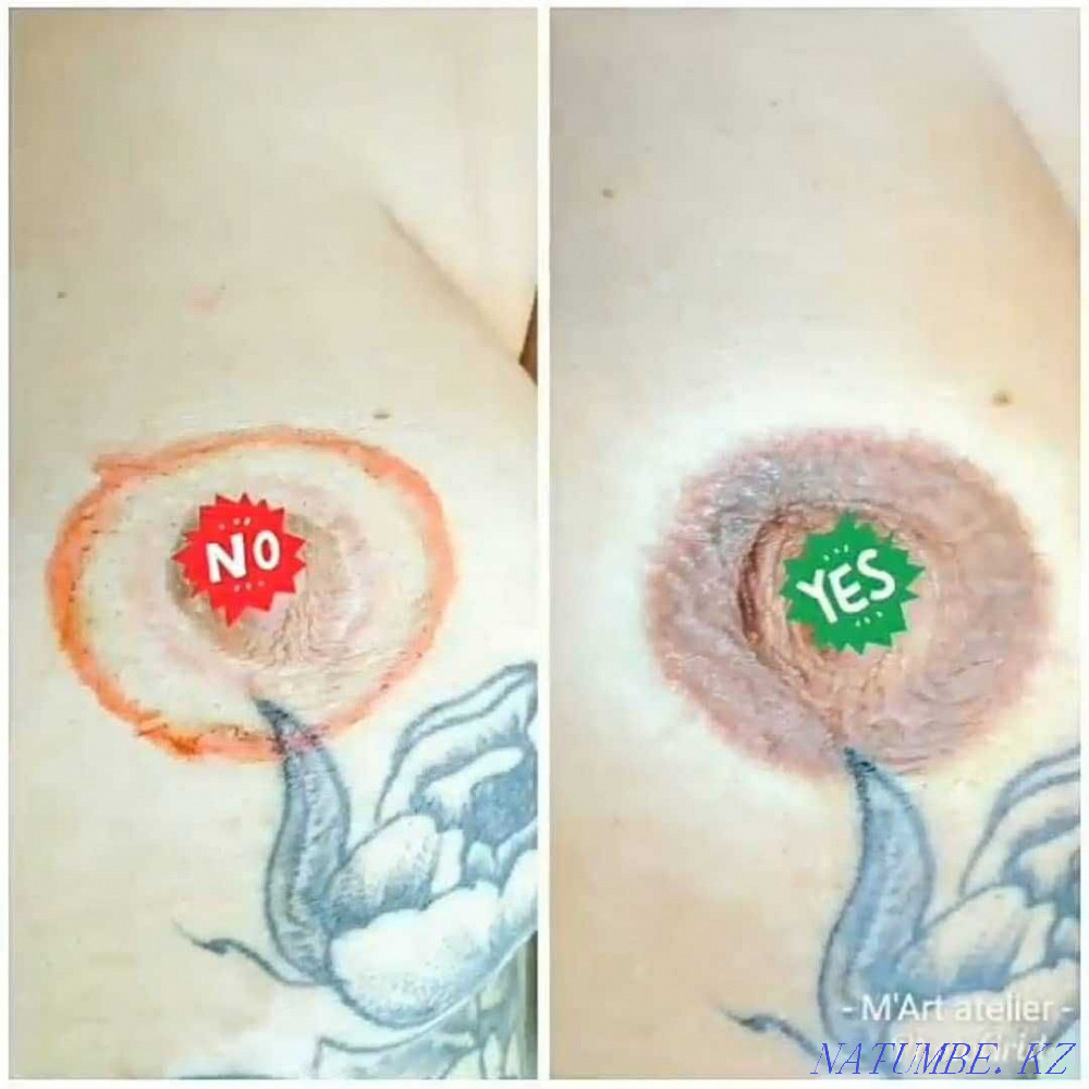 Перманентный татуаж, лазерное удаление, карбoновый пилинг, BrowBar Алматы - изображение 3