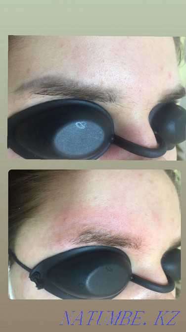 I will remove your tattoo from 4000 thousand tenge and tattooing 5000 tenge Temirtau - photo 6