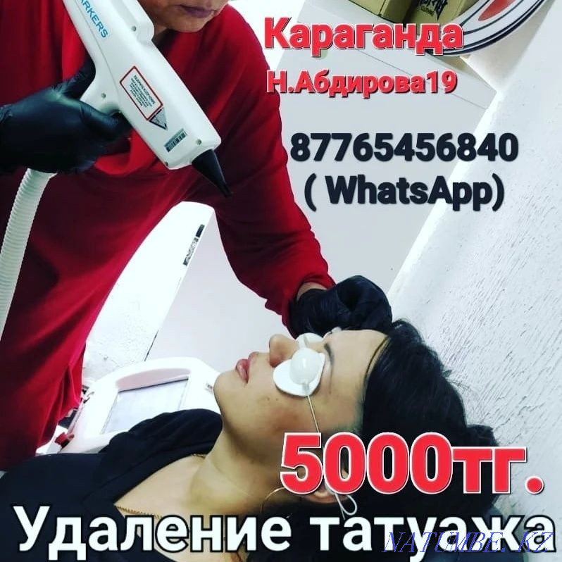 Tattoo removal, tattoo. Karagandy - photo 1