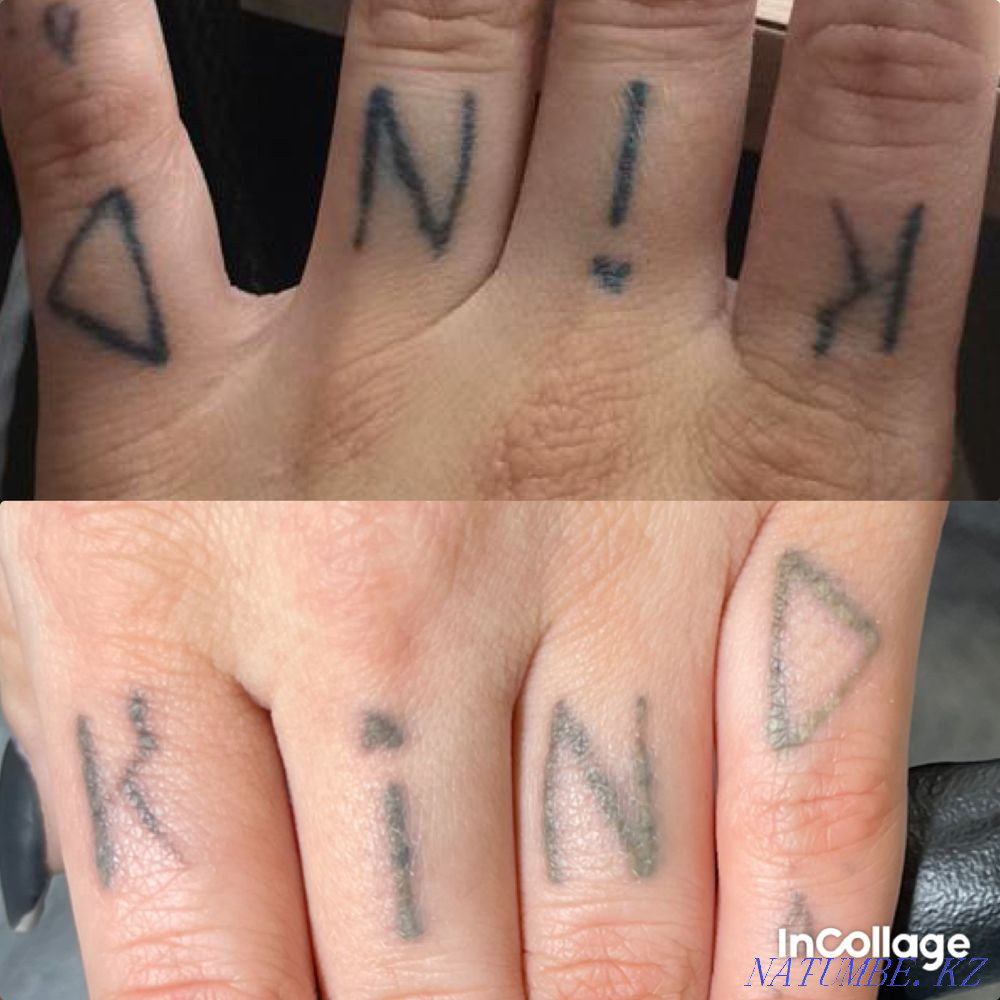 Removal of old, not high-quality tattoo, tattoos! Petropavlovsk - photo 5
