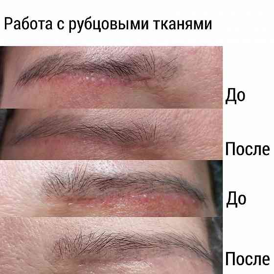 Перманентный макияж / удаление татуажа / рубцы / модели Алматы