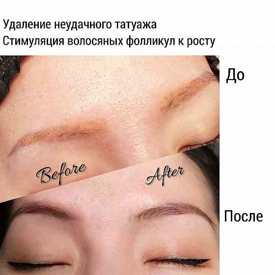 Перманентный макияж / удаление татуажа / рубцы / модели  Алматы