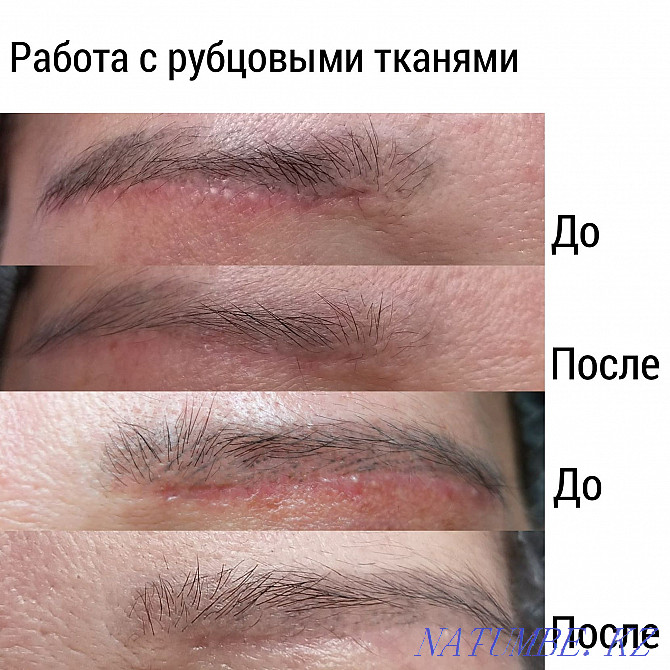 Permanent makeup / tattoo removal / scars / models Almaty - photo 6