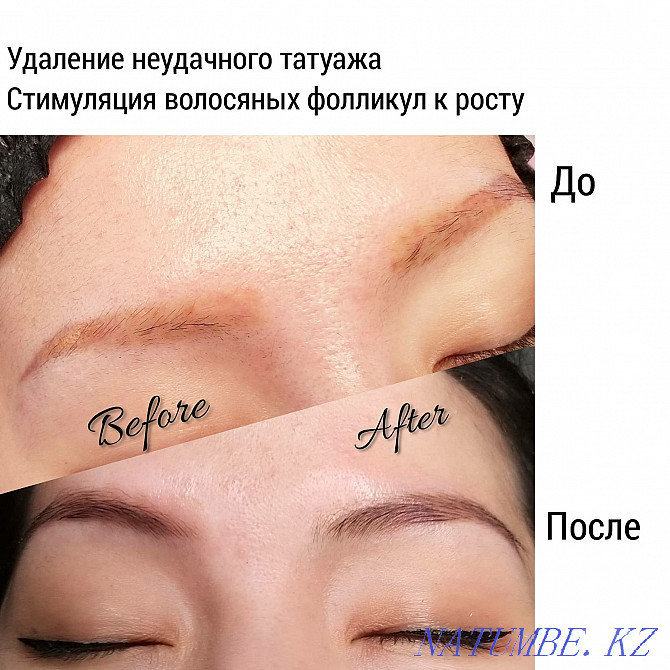 Permanent makeup / tattoo removal / scars / models Almaty - photo 5