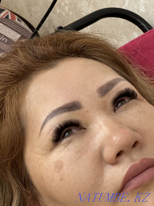 Tattoo removal 3500 Almaty - photo 7