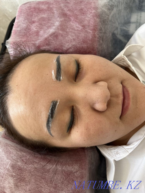 Tattoo removal 3500 Almaty - photo 2