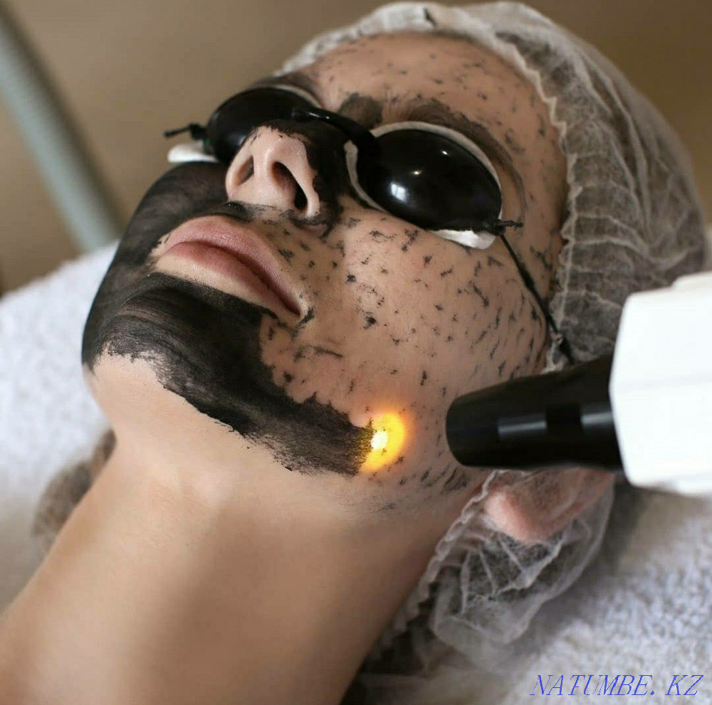 Лазерное удаление тату и татуажа Караганда - изображение 4