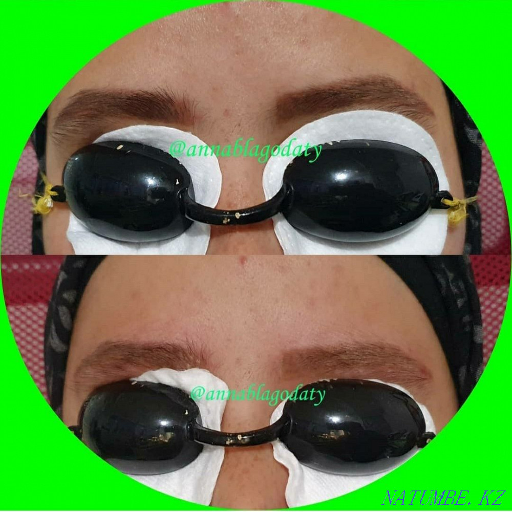 Лазерное удаление тату и татуажа Караганда - изображение 3