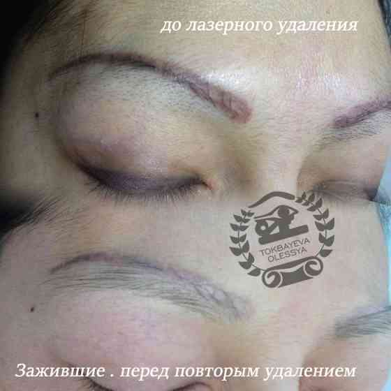 Удаление татуажа лазером, ремувером, от3500тг. Almaty