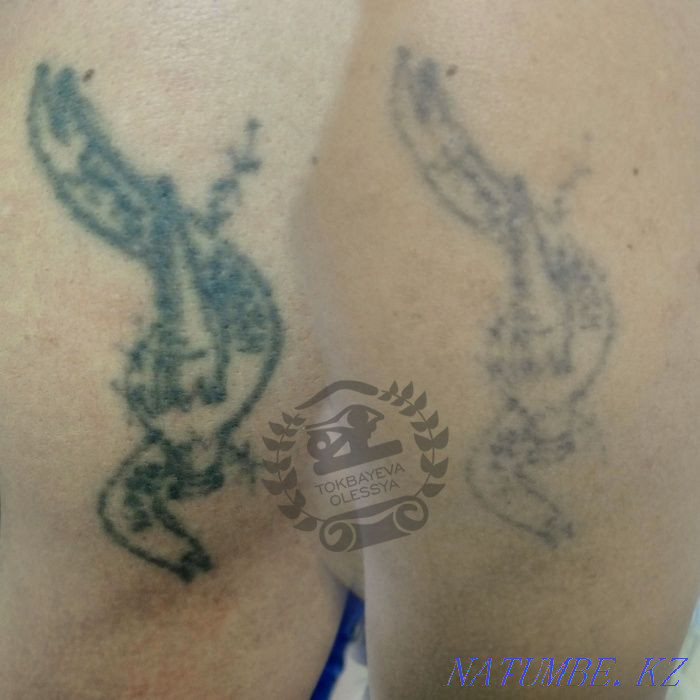 Удаление татуажа лазером, ремувером, от3500тг. Алматы - изображение 3