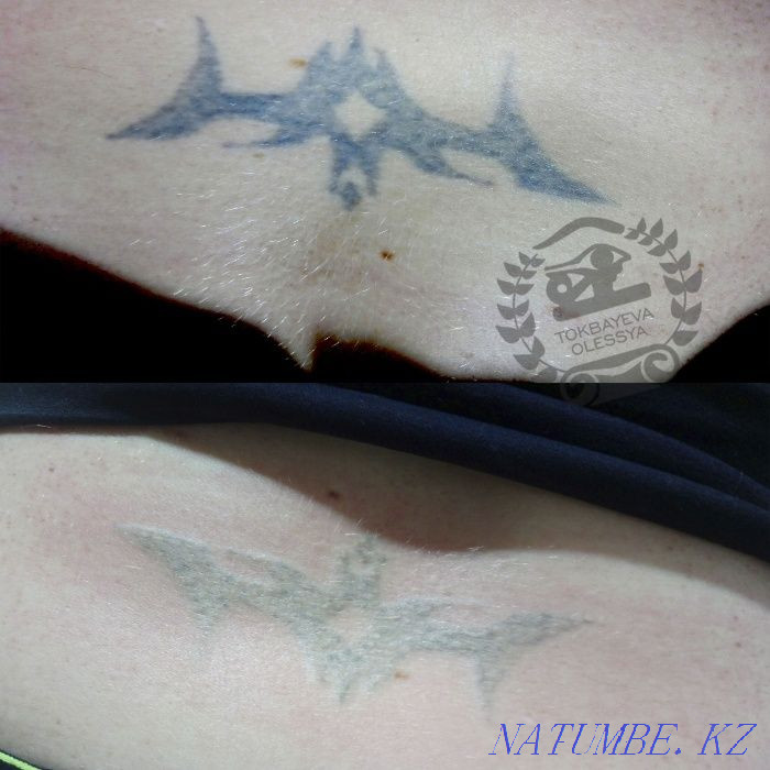 Удаление татуажа лазером, ремувером, от3500тг. Алматы - изображение 5