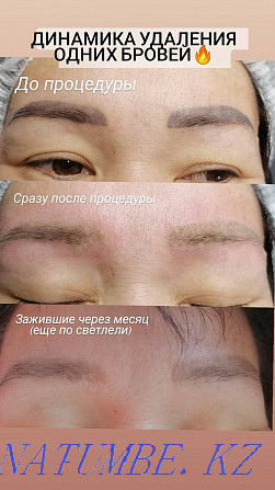 Laser tattoo removal! Kostanay - photo 1