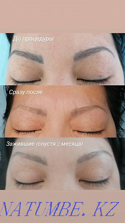 Laser tattoo removal! Kostanay - photo 2