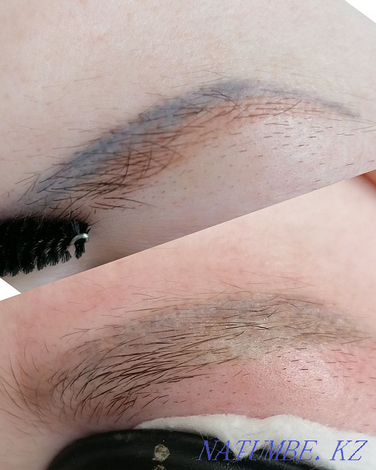 Laser tattoo removal! Kostanay - photo 5