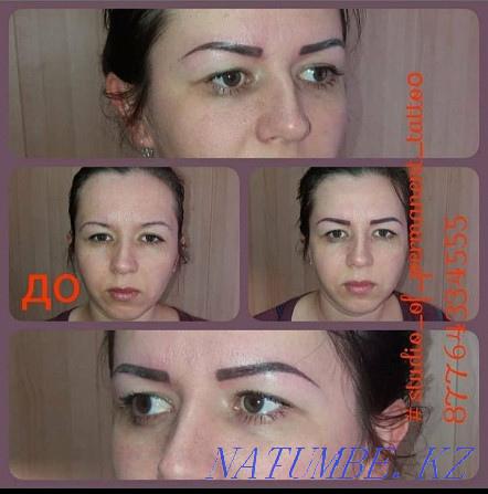 PM eyebrows and eyelids 7000t, lips 8000t Removal PM 3000 Pavlodar - photo 2