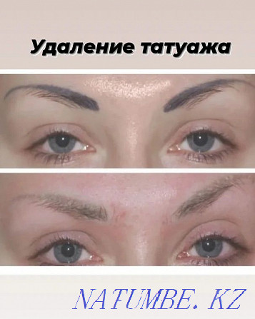 PM eyebrows and eyelids 7000t, lips 8000t Removal PM 3000 Pavlodar - photo 8