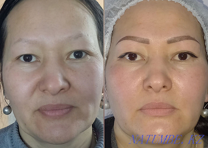 PM eyebrows and eyelids 7000t, lips 8000t Removal PM 3000 Pavlodar - photo 7