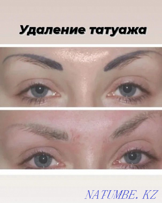 PM eyebrows and eyelids 7000t, lips 8000t Removal PM 3000 Pavlodar - photo 8