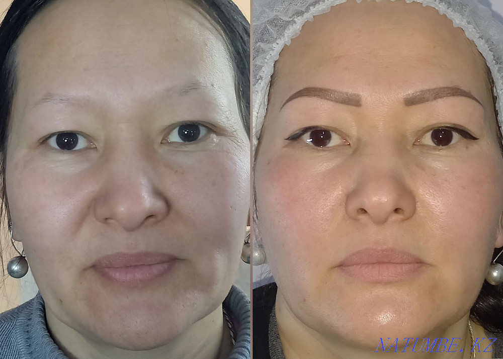 PM eyebrows and eyelids 7000t, lips 8000t Removal PM 3000 Pavlodar - photo 7