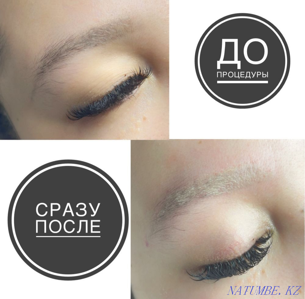 Laser tattoo removal, tattoo removal with a remover Karagandy - photo 5