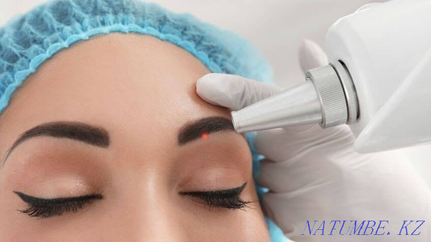 Laser tattoo removal, tattoo removal with a remover Karagandy - photo 1