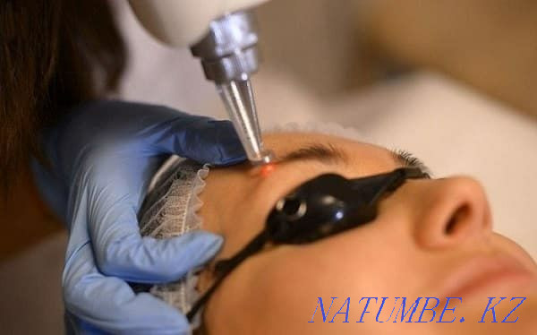Eyebrow lip tattoo removal with laser Qaskeleng - photo 3