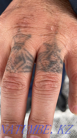 Удаление татуажа 3000 и татуировок лазером с 50% Астана - изображение 7
