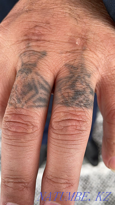 3000 татуировканы алып тастау және лазерлік татуировканы 50% алып тастау  Астана - изображение 7