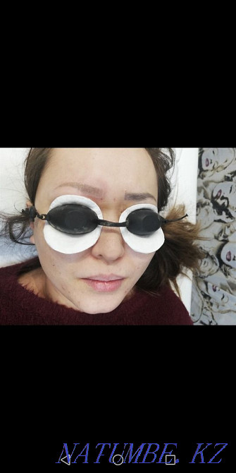 3000 татуировканы алып тастау және лазерлік татуировканы 50% алып тастау  Астана - изображение 3