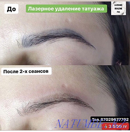 Laser tattoo and tattoo removal Pavlodar - photo 1