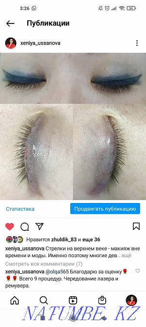 Удаление татуажа и тату Муратбаев - изображение 4