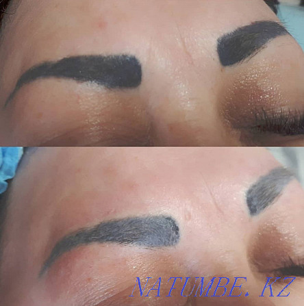 Removal of old or low-quality tattoo remover Temirtau - photo 3