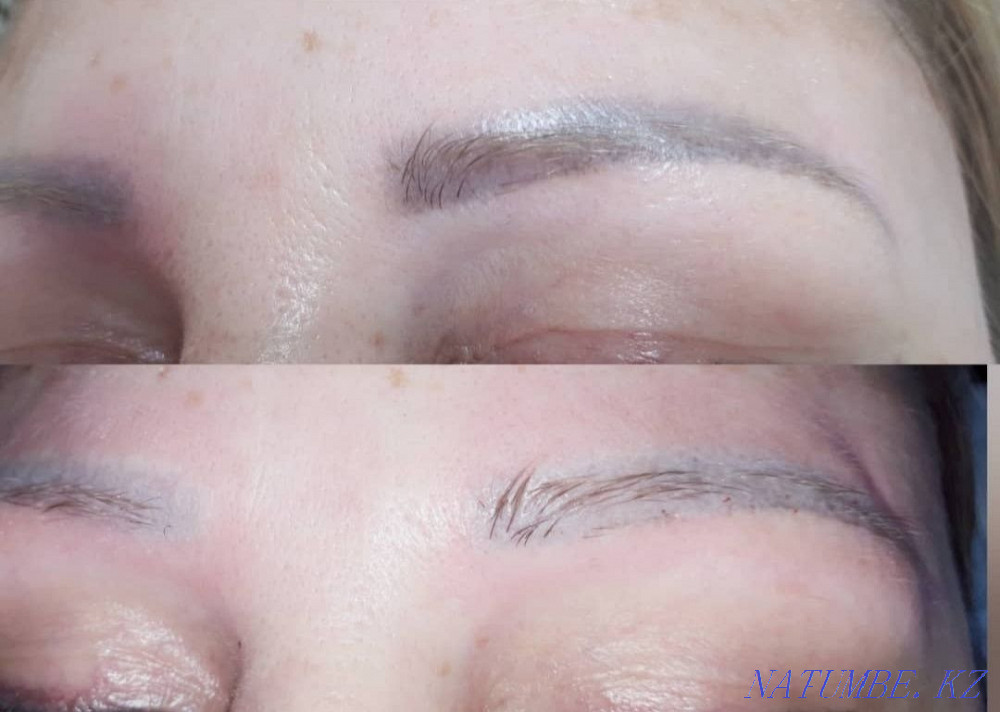 Удаление старого или некачественного татуажа Ремувером Темиртау - изображение 8