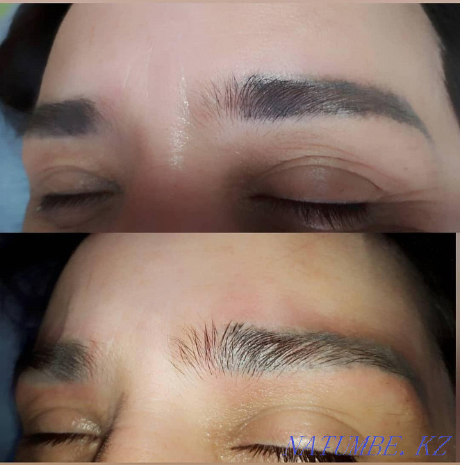 Удаление старого или некачественного татуажа Ремувером Темиртау - изображение 4