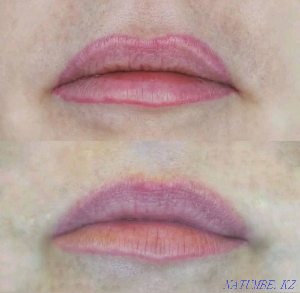 Удаление старого или некачественного татуажа Ремувером Темиртау - изображение 2