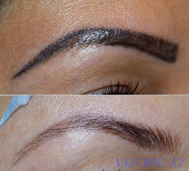 удаление татуировок,татуажа,пм Астана - изображение 2