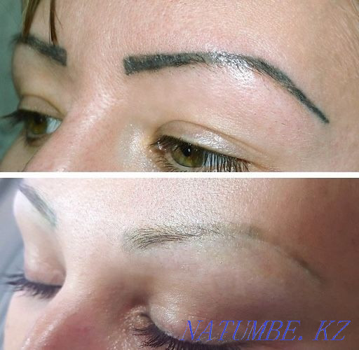 удаление татуировок,татуажа,пм Астана - изображение 3