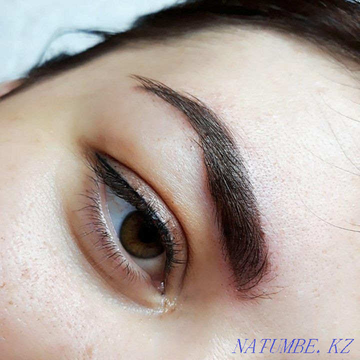 Plasma lift 15000 non-surgical blepharoplasty Almaty - photo 4
