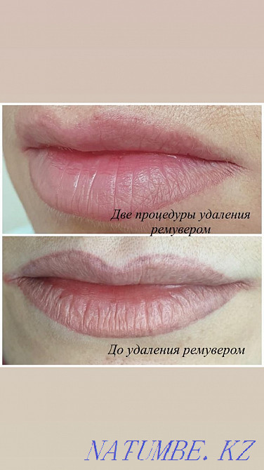 Татуировка қасы ерін көрсеткілері мен татуировканы алып тастау. Жоюшы, лазер  Астана - изображение 3
